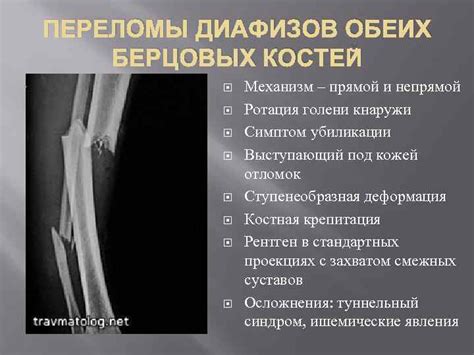 Перелом костей, симптомы и диагностика перелома. лечение перелома костей