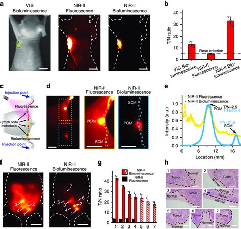 ATP Mediated NIR II BPs For Tumor And Metastases Imaging A VIS