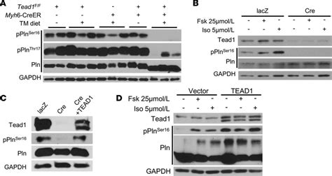 Tead1 Is Required For The Phosphorylation Of Phospholamban Pln A