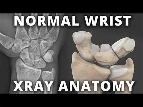 Wrist Anatomy Xray