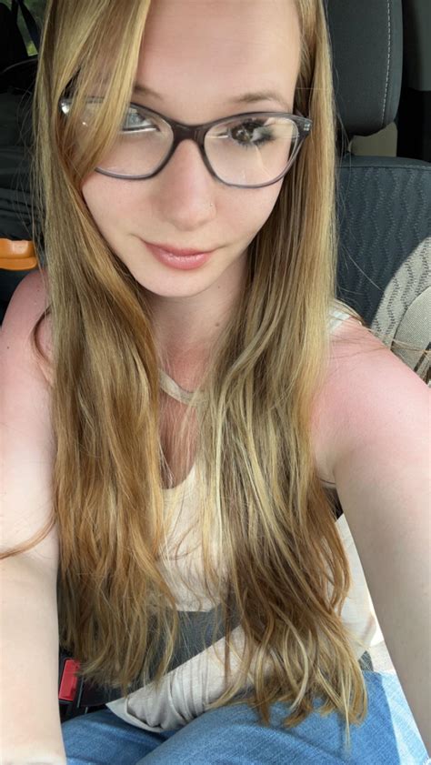 Sun burn : r/OnlyFaces