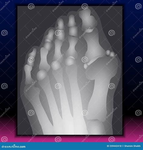 X-ray of Foot - Human Anatomy - Healthcare - Science Stock Illustration ...