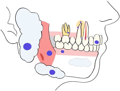 Frontiers Sex Steroid Hormones An Overlooked Yet Fundamental Factor In Oral Homeostasis In Humans