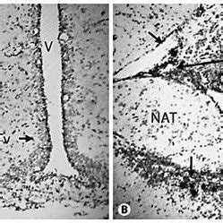 Bright Field Photomicrographs Of Transverse Sections Of The Goldfish