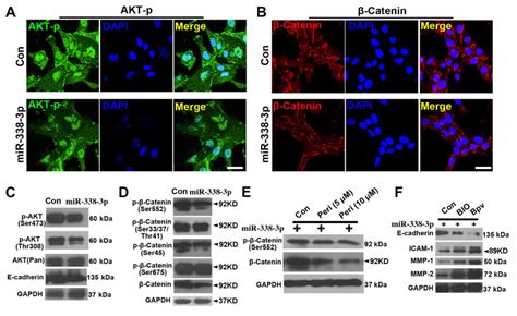 Mir‑338‑3p Inhibits A549 Lung Cancer Cell Proliferation And Invasion By