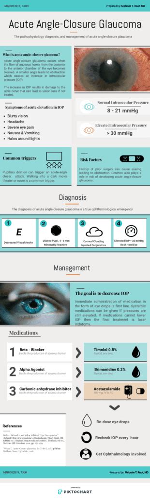 Acute Angle Closure Glaucoma Thomas Jefferson Emergency Medicine