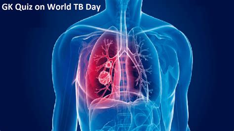 Gk Questions And Answers On The World Tuberculosis Day