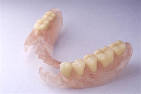 flexible-partial-dentures - South Calgary Denture and Implant Clinic