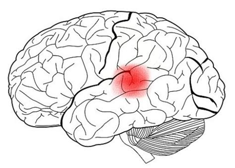 Wernicke's Area and Language Comprehension - Exploring your mind