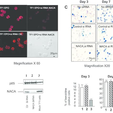 Effect Of Suppression Of Naca By Rnai On Hemoglobin Expression In Tf