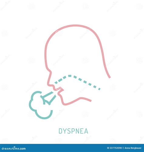 Respiratory Distortion, Insufficiency, Irregular Breathing, Ventilatory