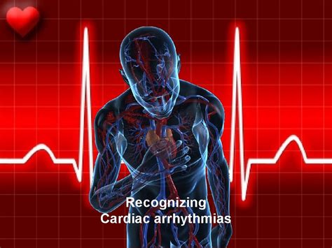 Recognizing Cardiac arrhythmias Normal anatomy Normal ECG Normal