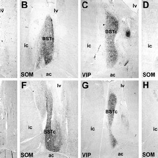 Representative Photomicro Graphs Depicting The Bstc In Males Top Row