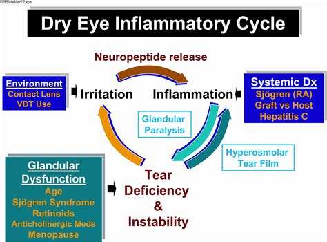 Cycle Of Dry Eye Inflammation American Academy Of Ophthalmology