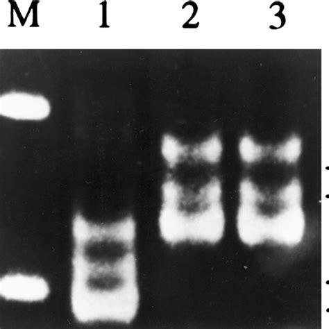 Amplification Pattern Obtained Using Rapd Primers To Identify The