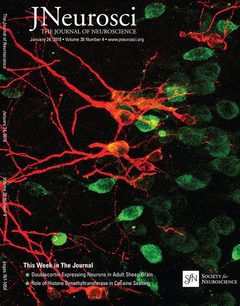 Readiness Potential And Neuronal Determinism New Insights On Libet Experiment Journal Of