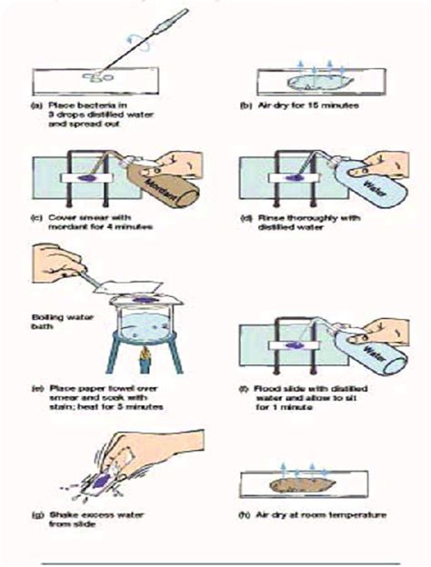 Procedures Of Flagella Staining Expected Results Bacterial Flagella