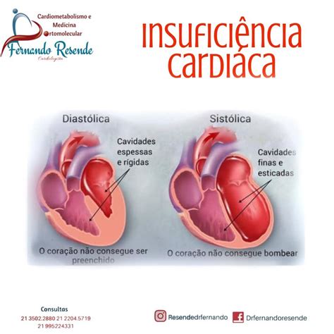 A Insuficiência Cardíaca é Um Exemplo De Distúrbio Cardiovascular