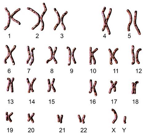 Cromossomos Resumo Classifica O E Tipos De Cromossomos Biologia Net