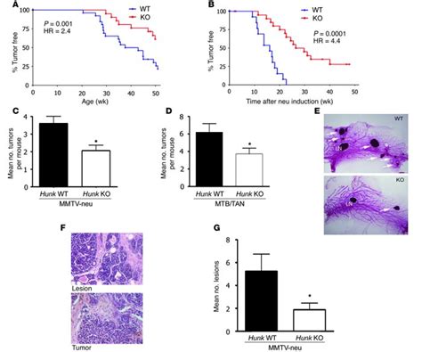 JCI Hunk Is Required For HER2 Neu Induced Mammary Tumorigenesis