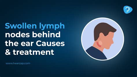 Swollen Lymph Nodes Behind Ear: Causes & Treatment