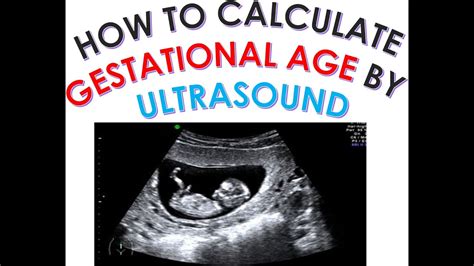 Obstetric Ultrasound Dating Telegraph