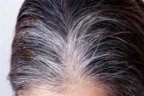 Estresse Causa Cabelo Branco - Estresse realmente causa cabelos brancos? Ciência revela como emoções ...