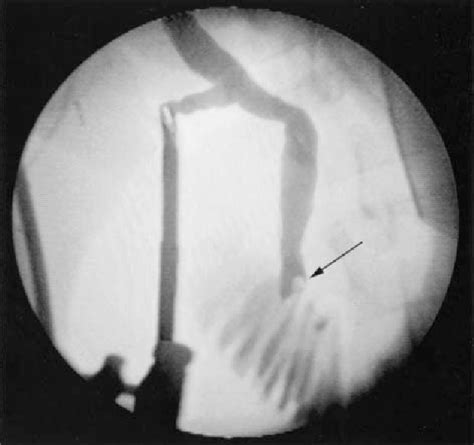 Figure From Laparoscopic Cholecystectomy Was Quickly Accepted