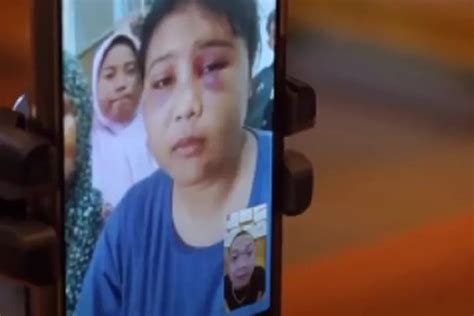 Foto Silvia Sebelum Jadi Korban Kdrt Suami Viral Di Tiktok Warganet