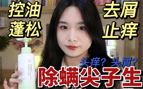 头痒？头屑？头上长疙瘩？快来除螨！别人撩头发是美女，你撩头发是六月飞雪想当 哔哩哔哩