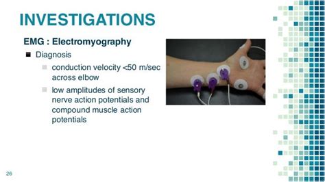 Cubital Tunnel Syndrome 1