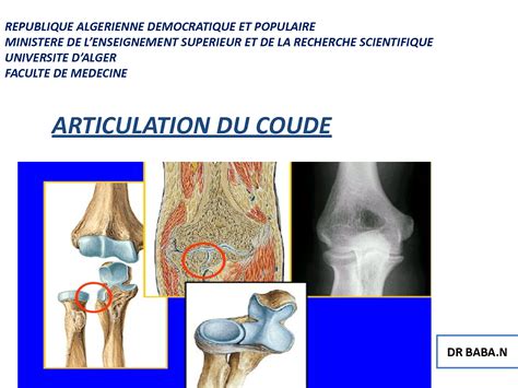 Solution Articulation Du Coude Anatomie Ere Annee Medecine Studypool