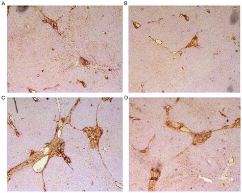 Comparison Of Bone Marrow‑vs Adipose Tissue‑derived Mesenchymal Stem