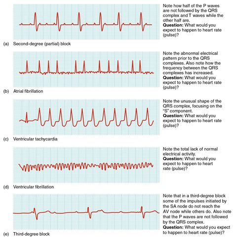 Cardiovascular System – Heart – Building a Medical Terminology Foundation