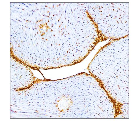 Cardiovascular Antibody Panel Irap Ireal Biotechnology Inc