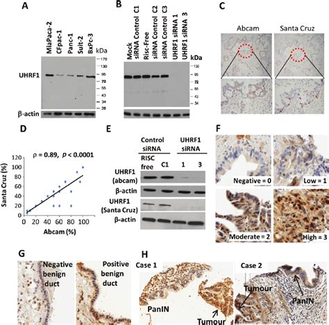 UHRF1 Is Over Expressed In Pancreatic Cancer A Western Blot Of UHRF1