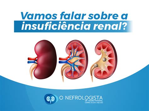 Vamos falar sobre a insuficiência renal O Nefrologista