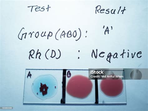 Foto de Teste De Grupo Sanguíneo E Fator Rh Por Método De Aglutinação ...
