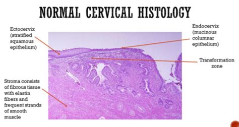 S M Path Of Vulva Vagina And Cervix Flashcards Quizlet