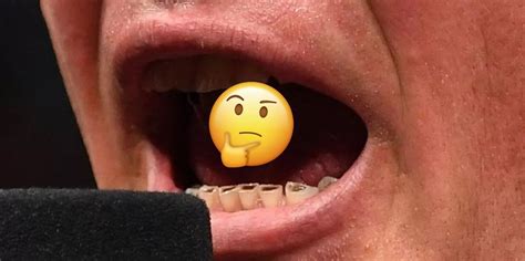 WTH? Something Seriously Wrong With Brock Lesnar’s Teeth – Fitness Volt