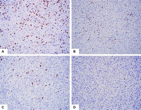 Representative Examples Of Cd8 Immunohistochemistry Stain The Positive