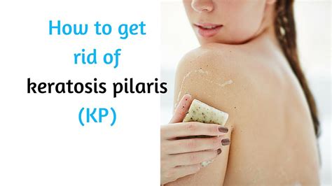 How To Get Rid Of Keratosis Pilaris Youtube