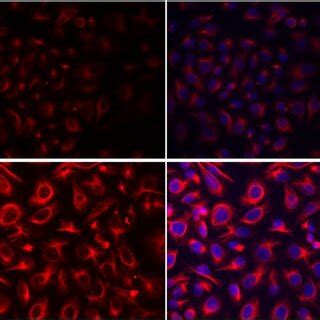 Vimentin Expression In Ovcar Parental And Ovcar Cbpr Cells