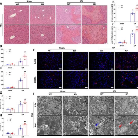 Hsf2bp Deficiency Exacerbates I R Induced Liver Injury Inflammatory Download Scientific