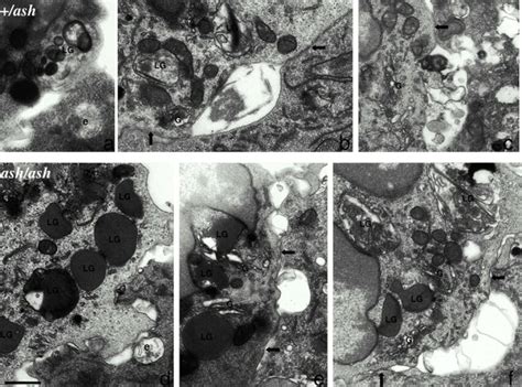 Lytic Granules Polarize With The Golgi Complex But Do Not Dock With The