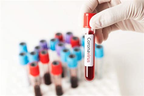 blood test images   png stickers wallpapers backgrounds