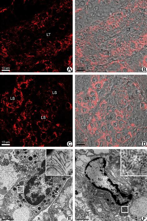 Confocal Laser Scanning And Tem Micrographs Of Yhv Infected Lymphoid