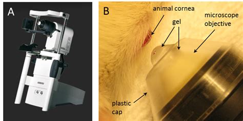 Laser Scanning In Vivo Confocal Microscopy Of The Cornea Imaging And