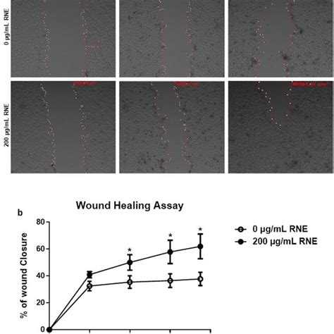 RNE Treatment Accelerates Wound Healing In Vitro Scratch Assays