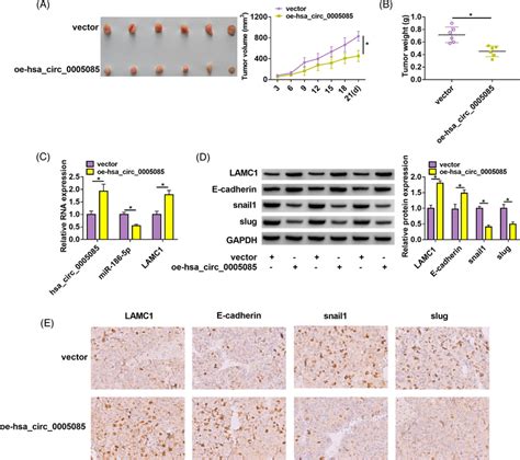 Overexpression Of Hsa Circ Could Inhibit Tumor Growth In Vivo